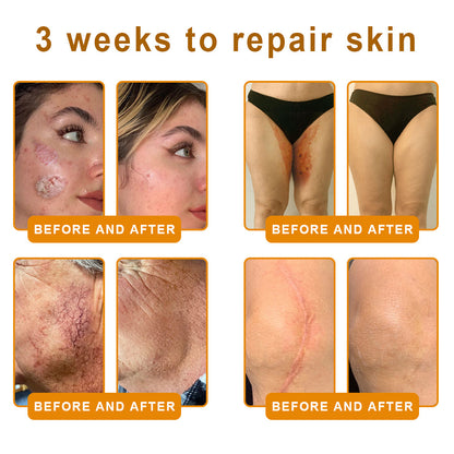 𝐋𝐎𝐕𝐈𝐋𝐃𝐒™ 𝐁𝐞𝐞 𝐕𝐞𝐧𝐨𝐦 𝐀𝐥𝐥-𝐢𝐧-𝐎𝐧𝐞 𝐂𝐫𝐞𝐚𝐦–🌸 Anti-aging,Hydrating, Skin Repair, Even Tone, Acne and Dark Spot Treatment, Wart and Mole Removal, Psoriasis Relief
