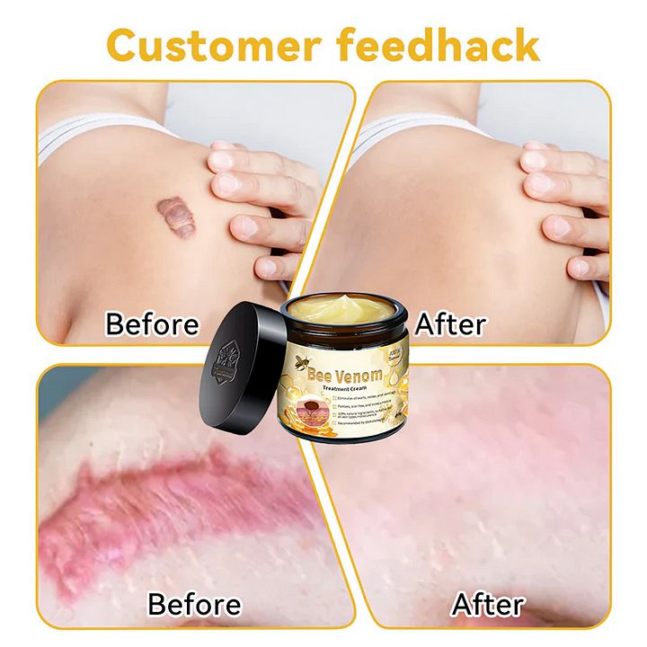 Professional Bee Venom Repair Cream, For All Body Parts