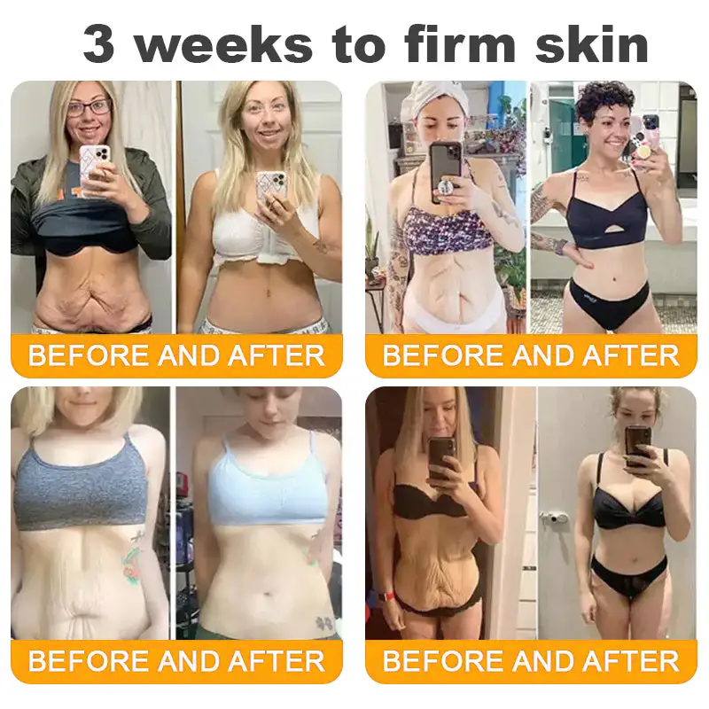 𝐋𝐎𝐕𝐈𝐋𝐃𝐒™ 𝐁𝐞𝐞 𝐕𝐞𝐧𝐨𝐦 𝐀𝐥𝐥-𝐢𝐧-𝐎𝐧𝐞 𝐂𝐫𝐞𝐚𝐦–🌸 Anti-aging,Hydrating, Skin Repair, Even Tone, Acne and Dark Spot Treatment, Wart and Mole Removal, Psoriasis Relief